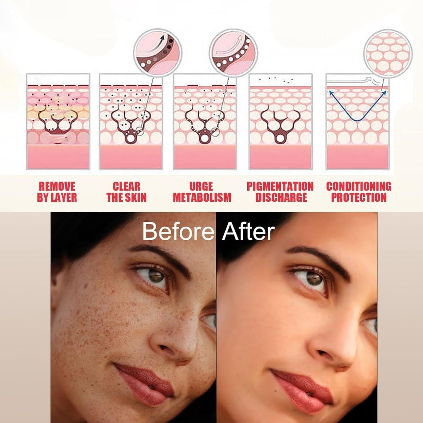 tranexamic acid and niacinamide serum for melasma treatment