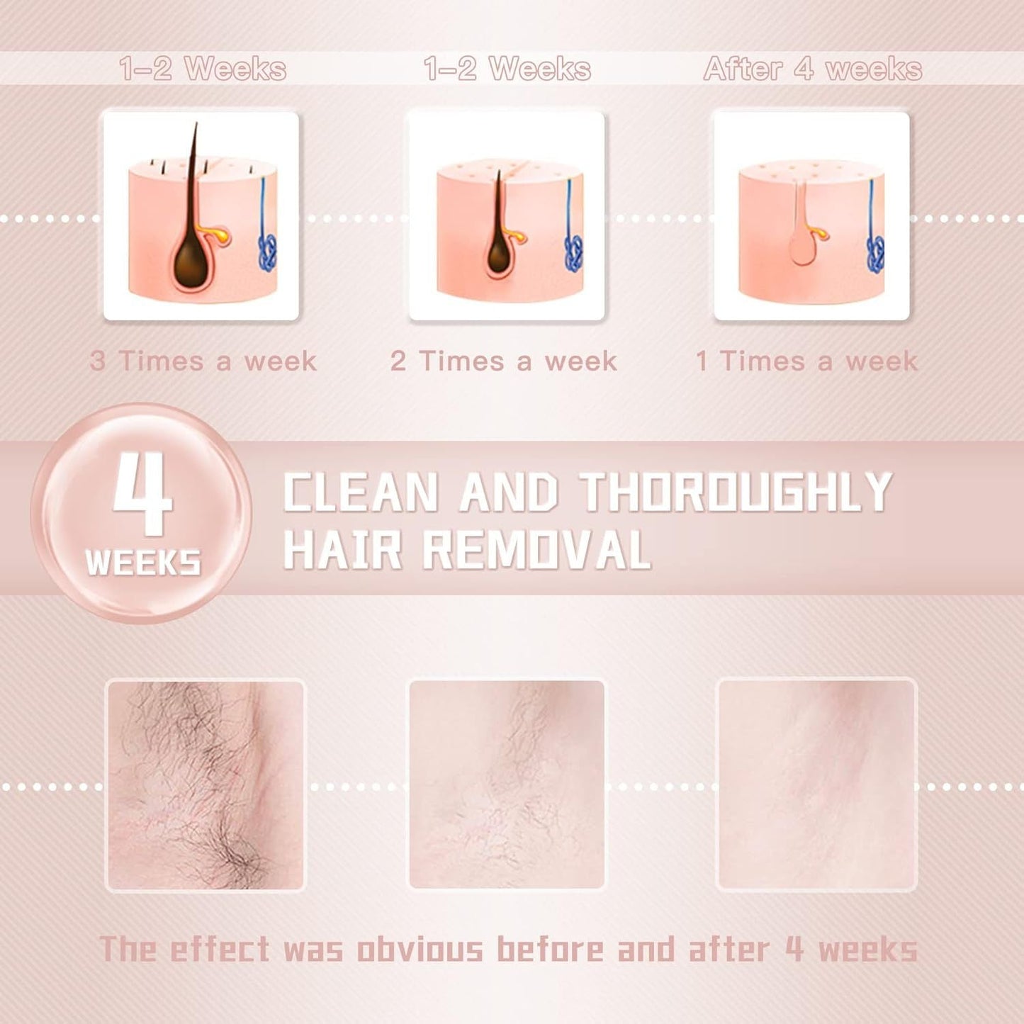 IPL hair removal laser machine with ice cooling technology for sensitive skin