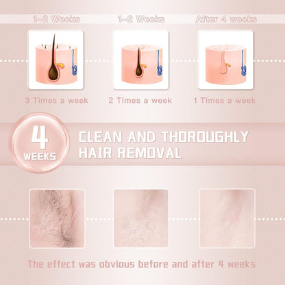 IPL hair removal laser machine with ice cooling technology for sensitive skin