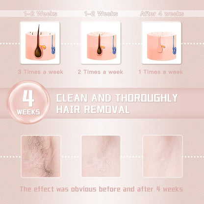 IPL hair removal laser machine with ice cooling technology for sensitive skin