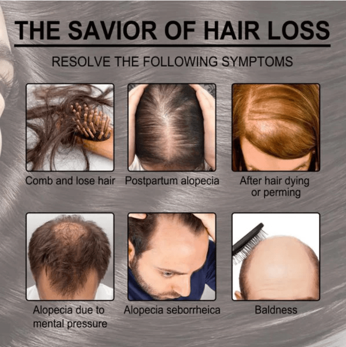 Applying rosemary oil to scalp for hair regrowth and hair fall control